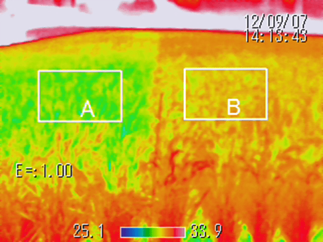 サーモグラフィー